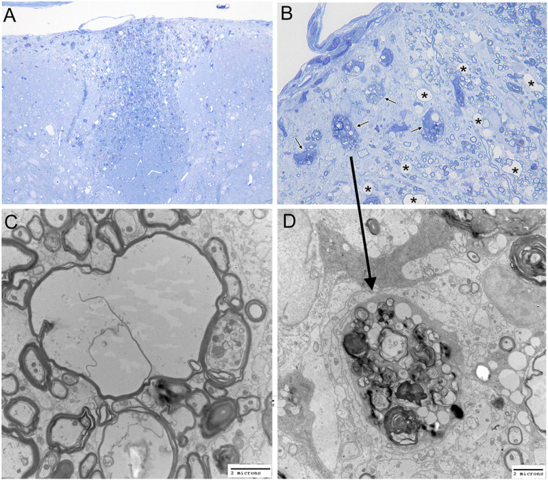 FIG 11