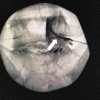 Fig. 3