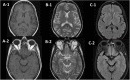 Fig 2: