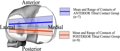 Fig. 3-A Fig. 3-B