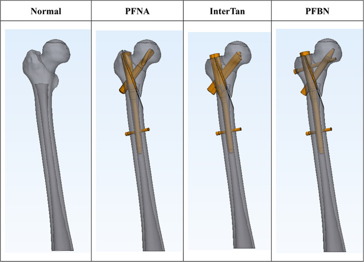 FIGURE 3