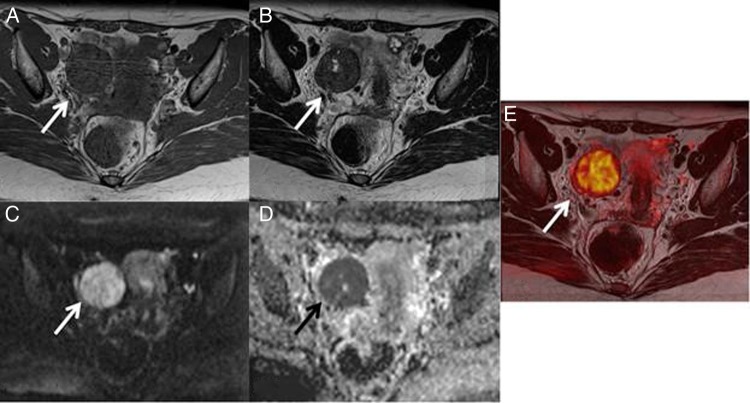 Figure 1