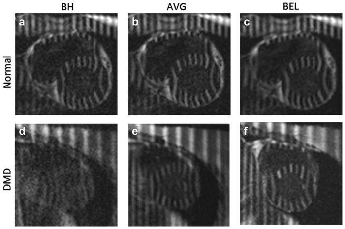 FIG. 1