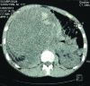 Fig. 2.