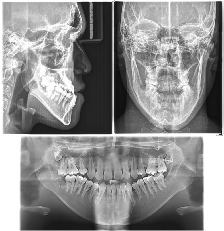 Fig. 8