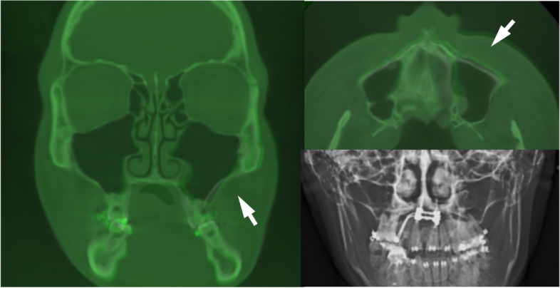 Fig. 15
