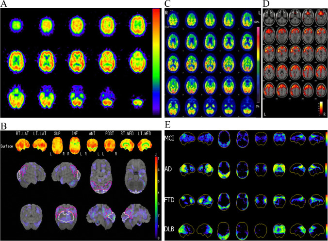 Fig. 3