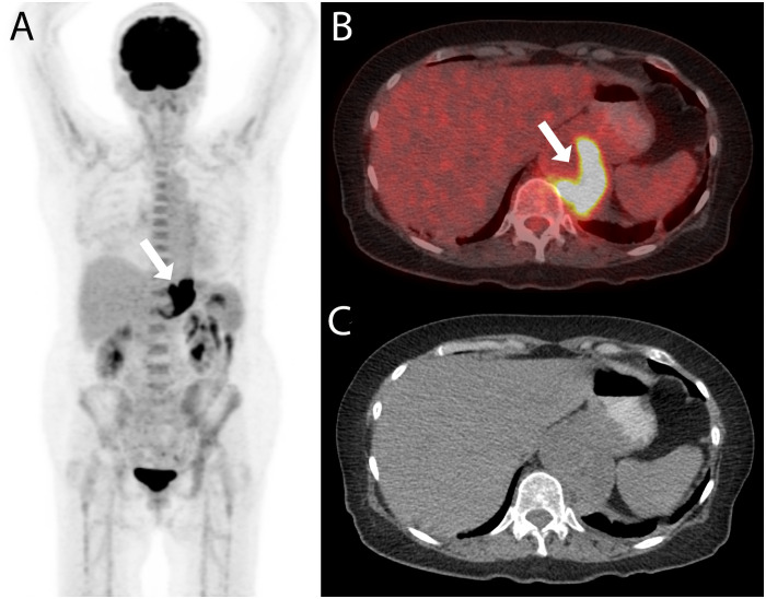 Fig 3