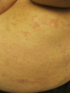 Figure 2B.
