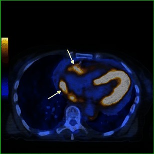 Fig. 14