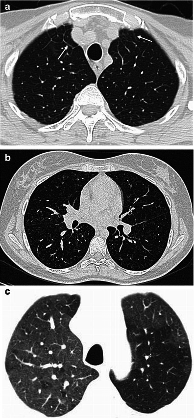 Fig. 15