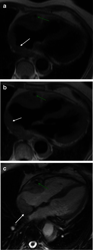 Fig. 13