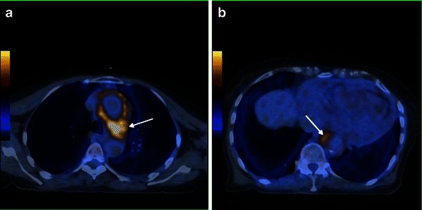 Fig. 10