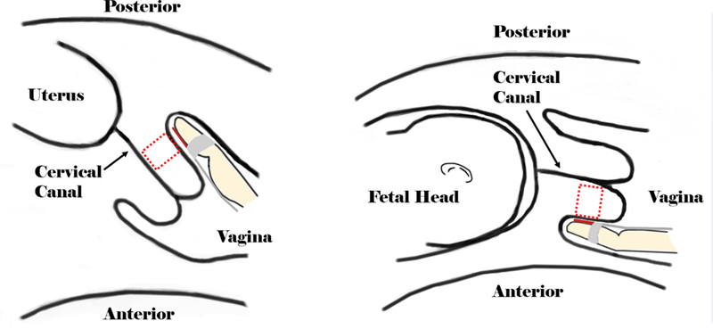 Figure 2: