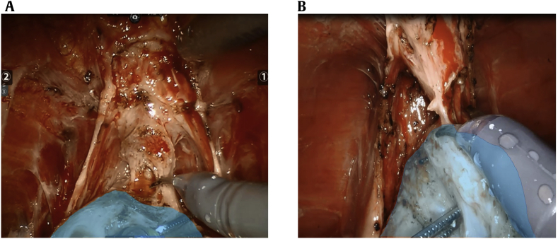 Fig. 3