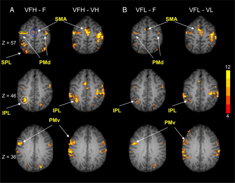 FIG. 4