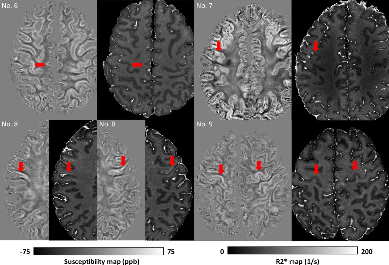 Fig 7