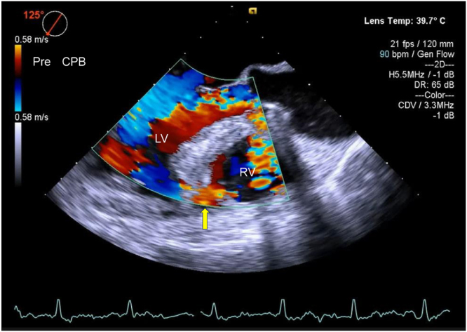 Figure 3