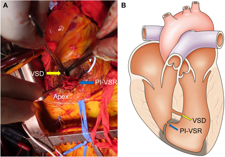 Figure 5