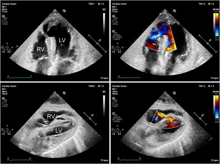 Figure 2