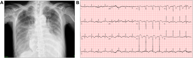 Figure 1