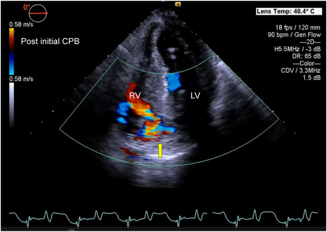 Figure 4