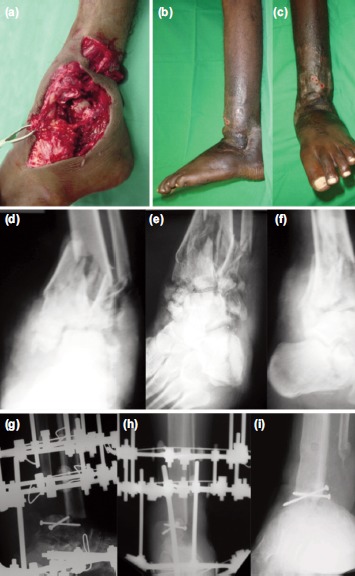 Fig. 3: