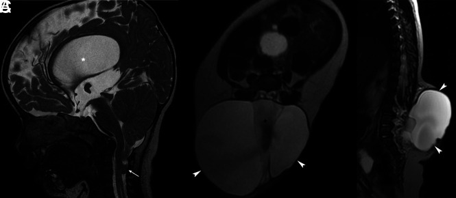 FIG 3.