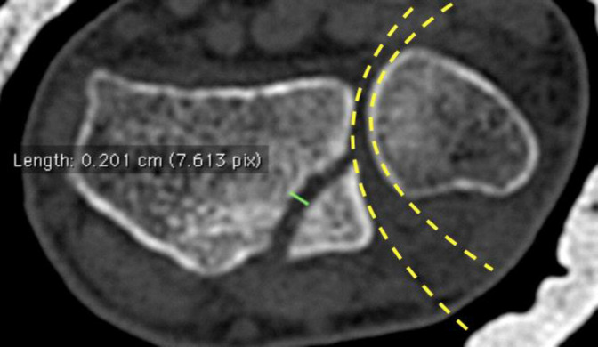 Figure 9