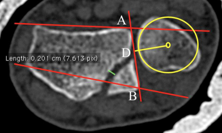 Figure 11