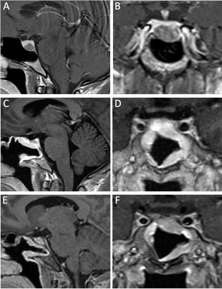 Figure 2