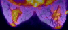 Fig 9