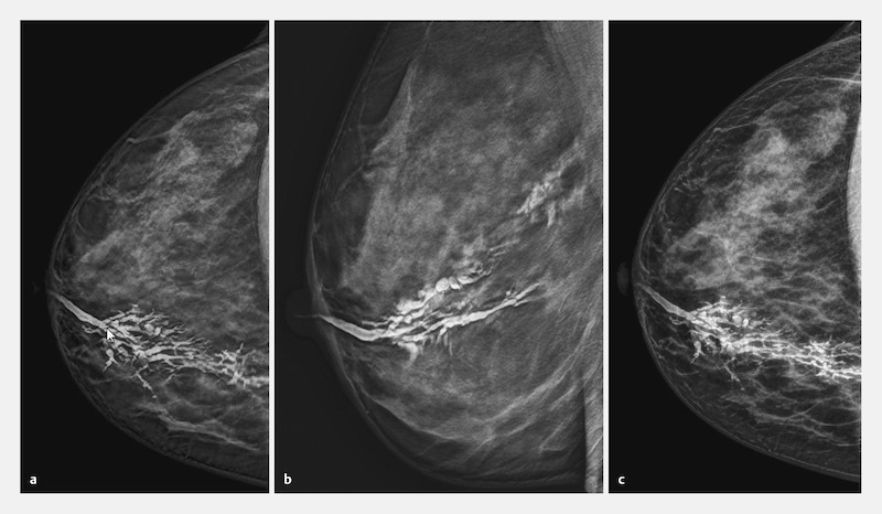 Fig. 1