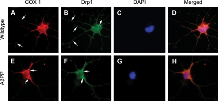 Figure 11.