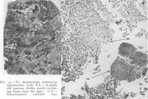 Fig. 13