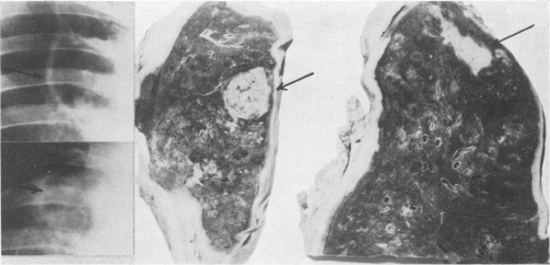 Fig. 12