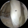 Fig 10
