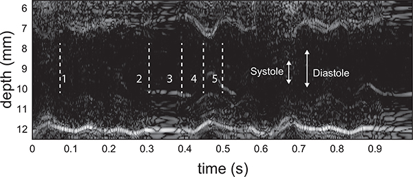 Fig. 11.