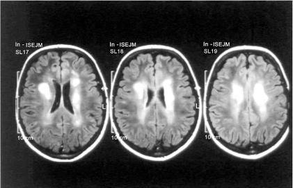 Fig. (1)