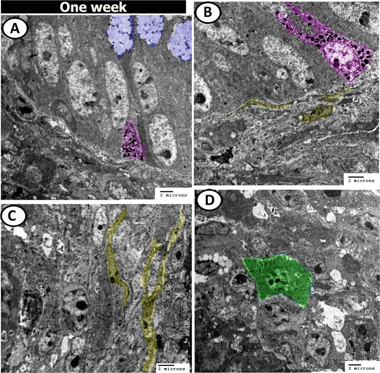 Figure 18