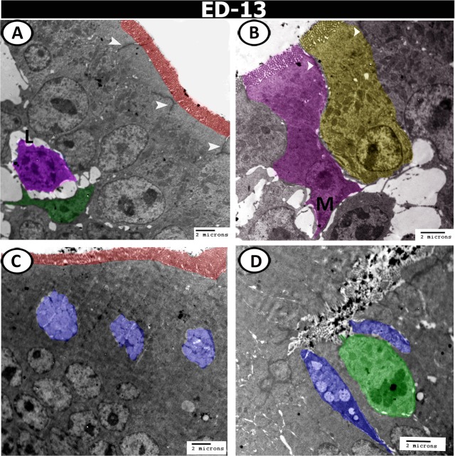 Figure 13