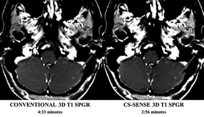 Fig 2.