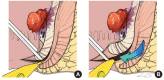 Fig. 11.