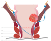 Fig. 15.