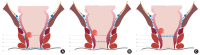 Fig. 10.