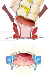 Fig. 16.