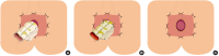 Fig. 22.