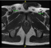 Fig. 21.