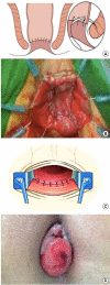 Fig. 12.