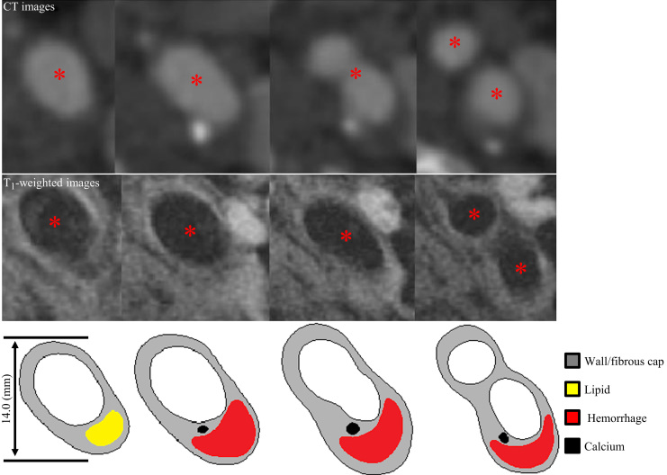 Fig. 1